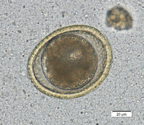 Toxocara canis egg