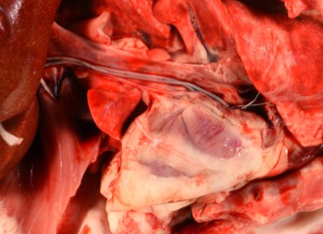 Adult D. immitis worms within the caudal vena cava of a cat.