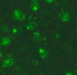 Positive test result with immunofluorescence localized to nuclei