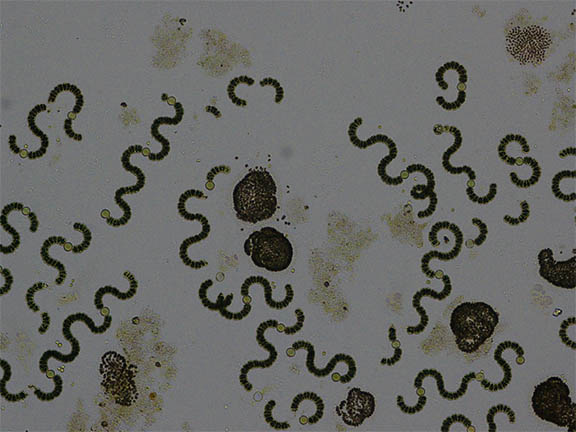 algal blooms under microscope